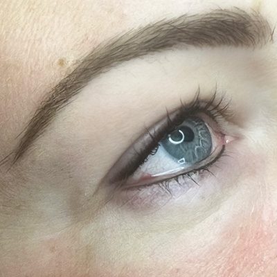 Lidpigmentierung Feiner Eyeliner Melissa Wefers