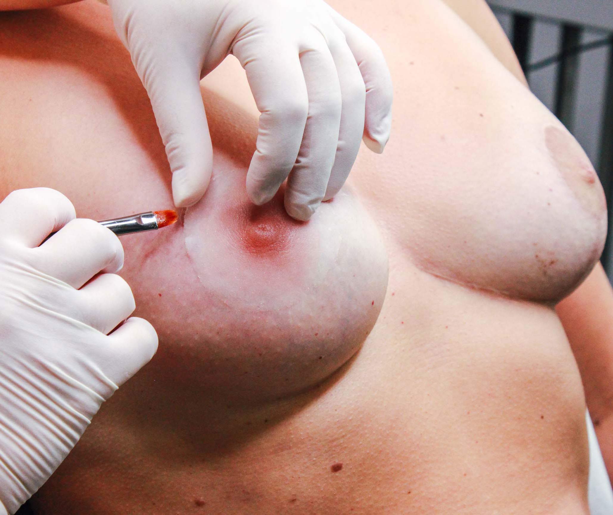 Melissa_Wefers_Oberhausen_Areola-Prothetik