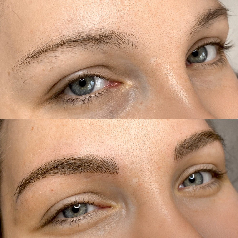 Melissa_Wefers_Oberhausen_Areola-Prothetik