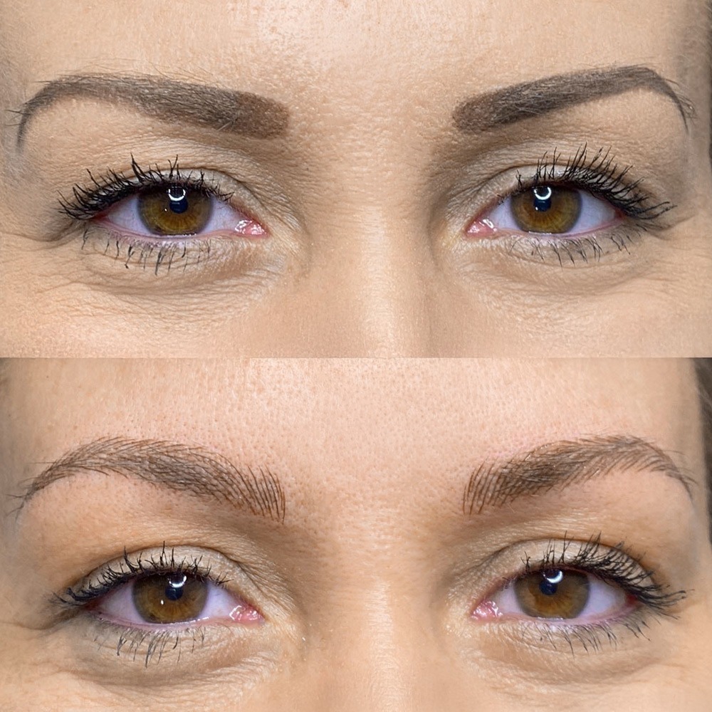 Melissa_Wefers_Oberhausen_Areola-Prothetik_Abdruck