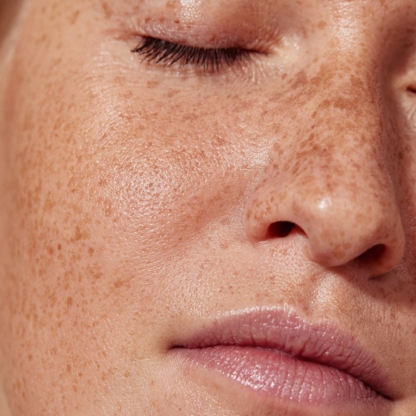 Melissa_Wefers_Oberhausen_Areola-Prothetik_Abdruck