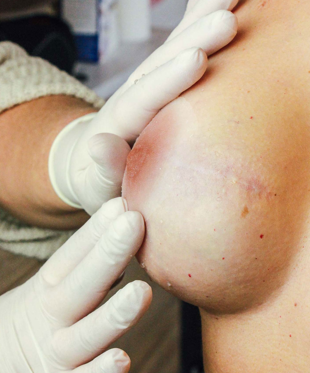 Melissa Wefers Pigmentistin Oberhausen ergebnis 2