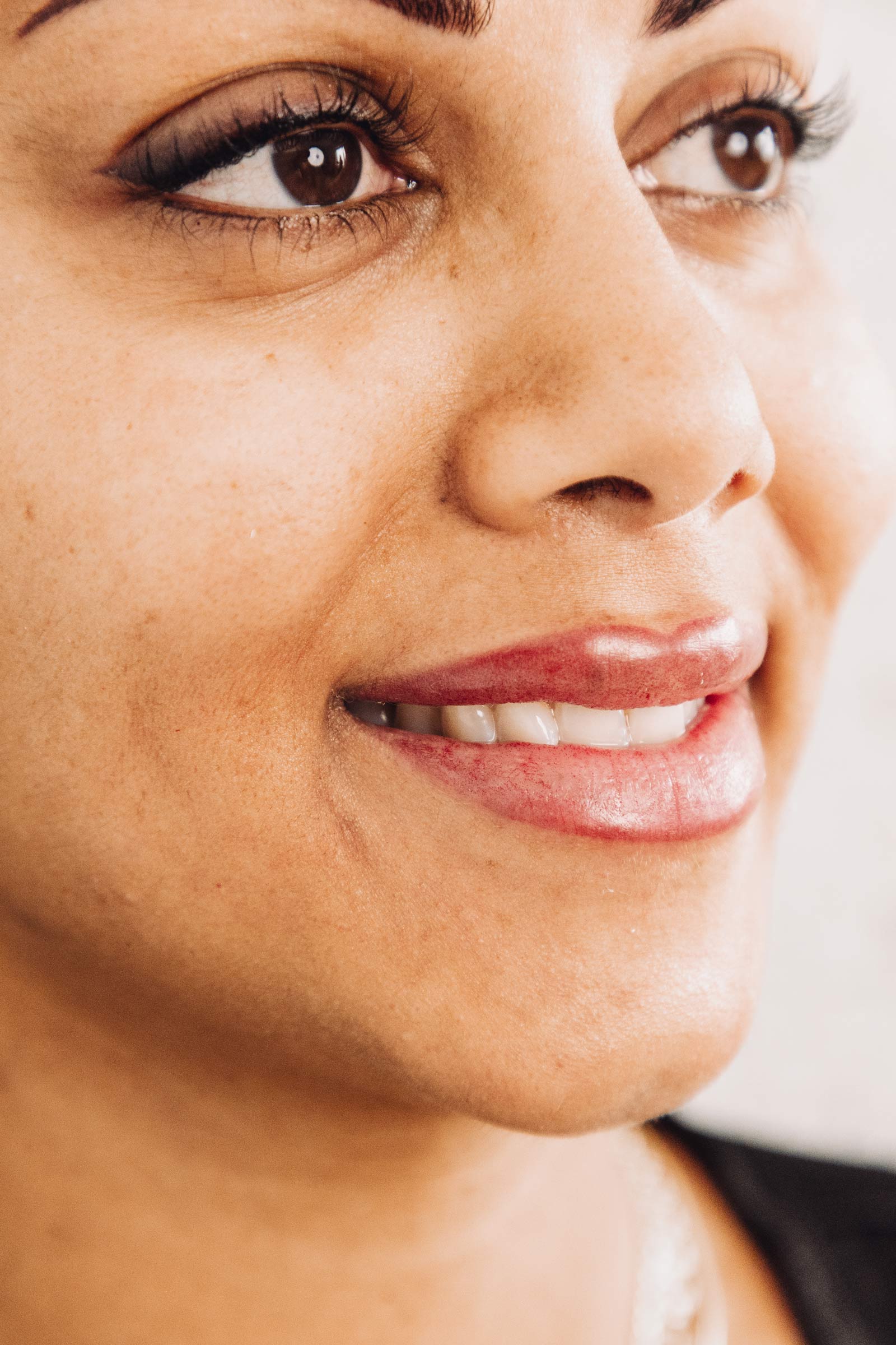 Melissa_Wefers_Oberhausen_Areola-Prothetik