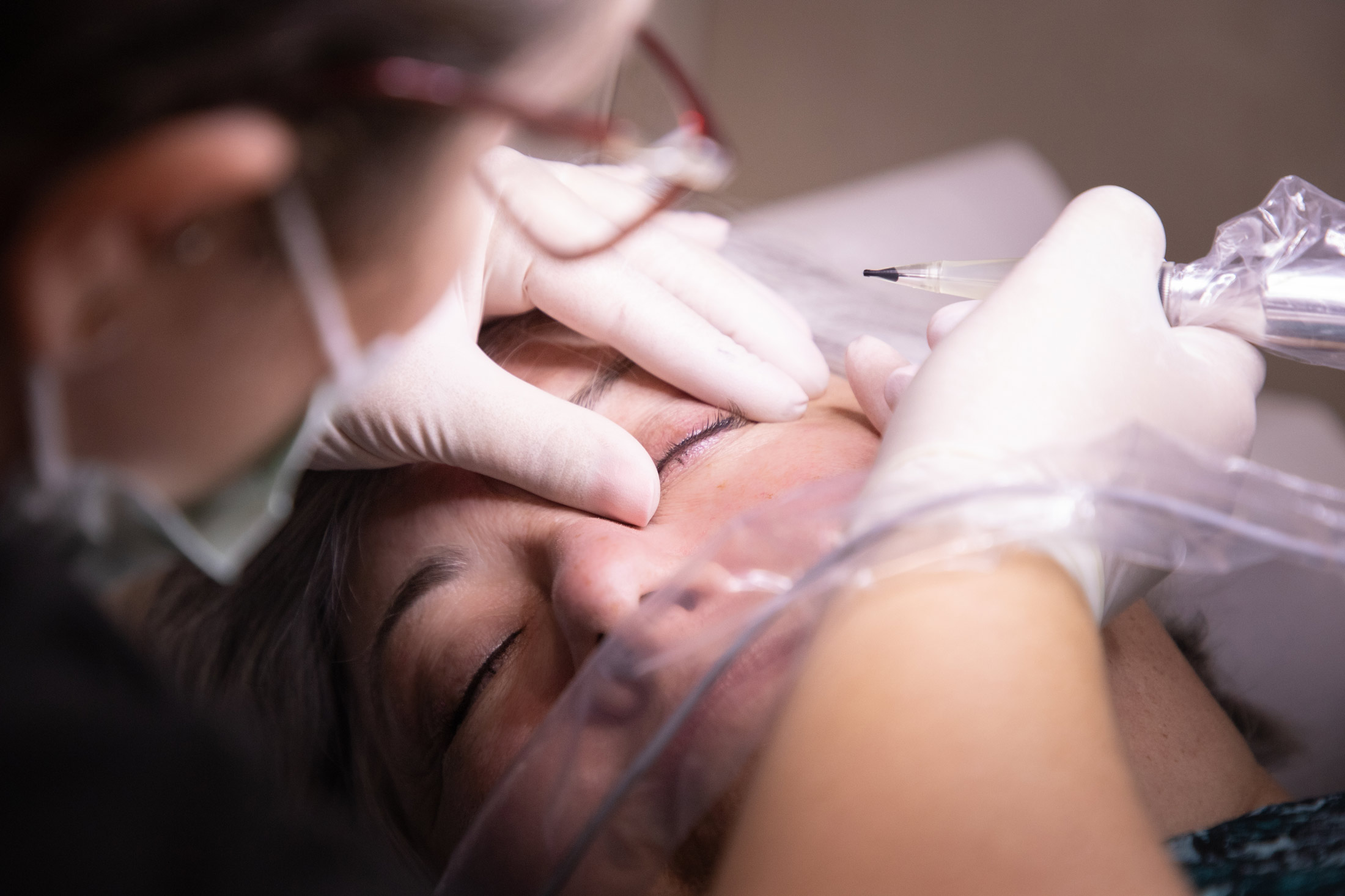 Melissa_Wefers_Oberhausen_Areola-Prothetik