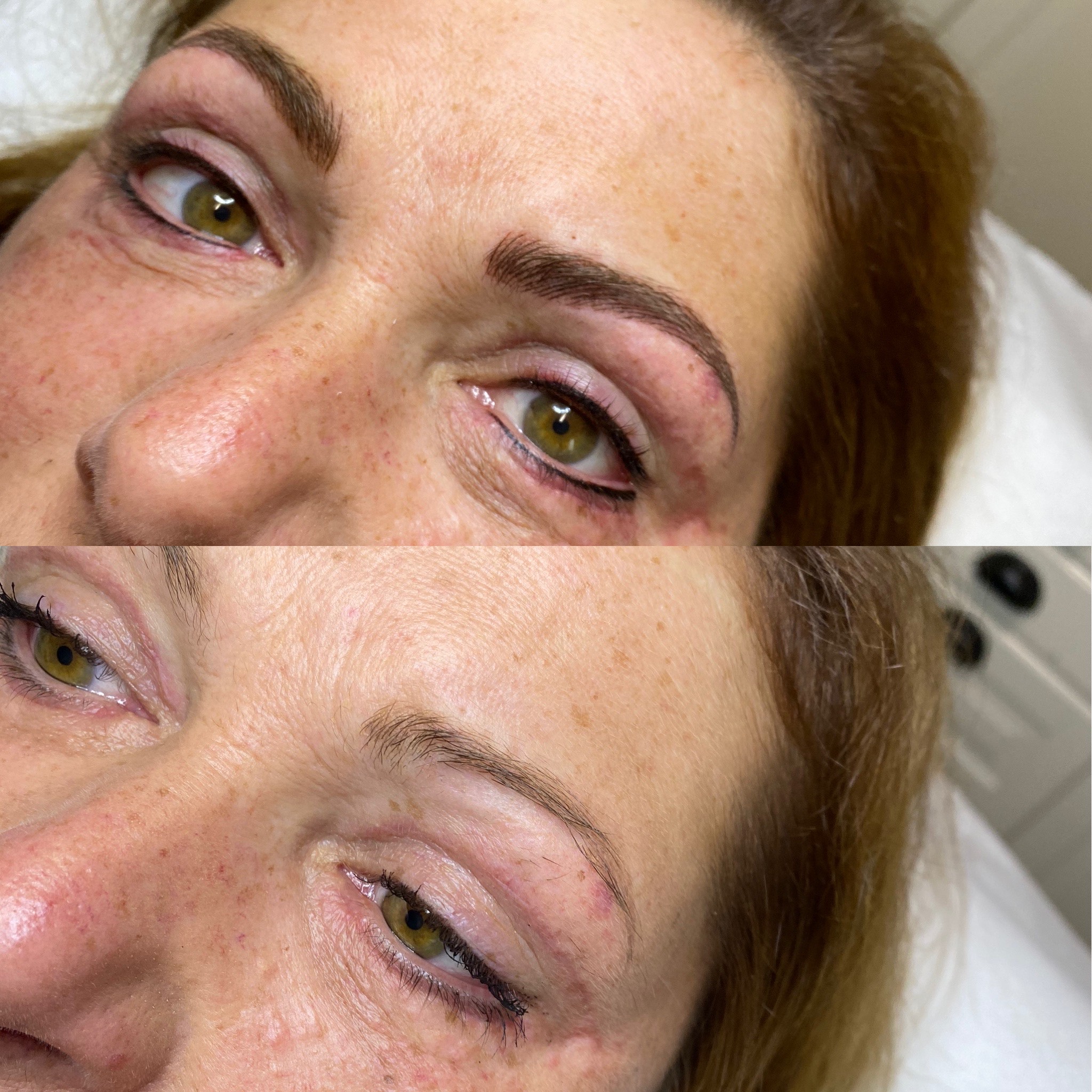 Melissa_Wefers_Oberhausen_Areola-Prothetik_Abdruck