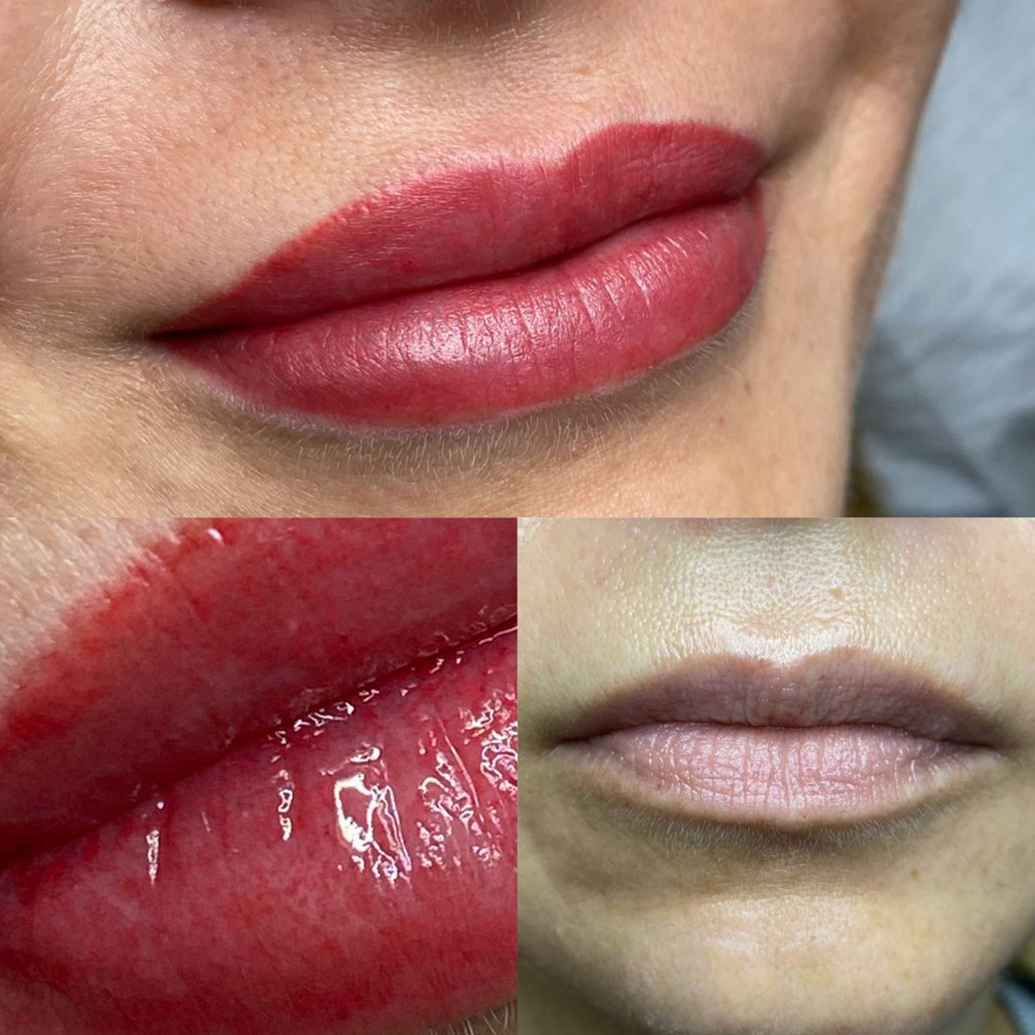 Melissa_Wefers_Oberhausen_Areola-Prothetik_Abdruck